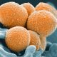 An electron microscope image shows Group A Streptococcus in orange