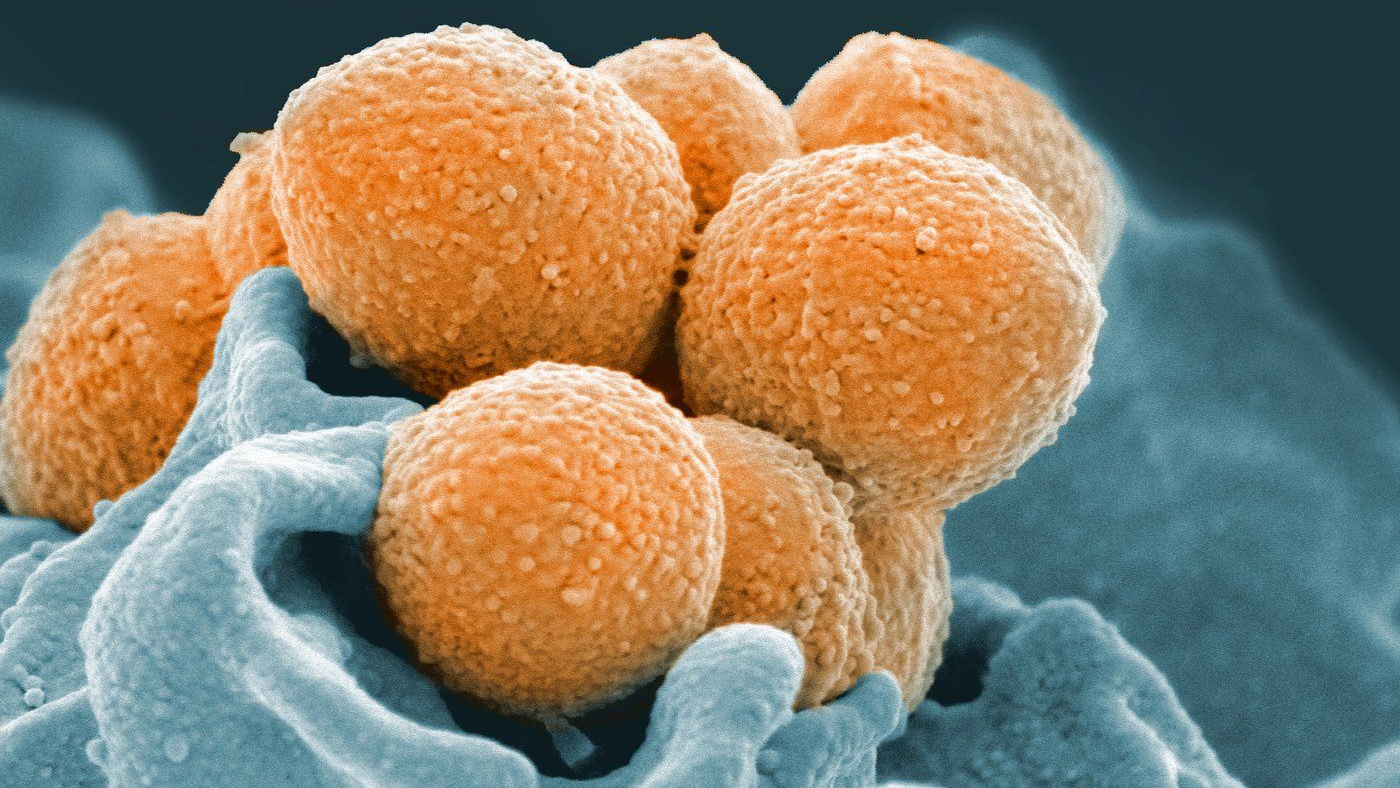 An electron microscope image shows Group A Streptococcus in orange