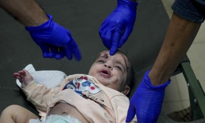 FILE - A Palestinian baby wounded in the Israeli bombardment of the Gaza Strip is treated in a hospital in Deir al-Balah on Tuesday, Nov. 14, 2023