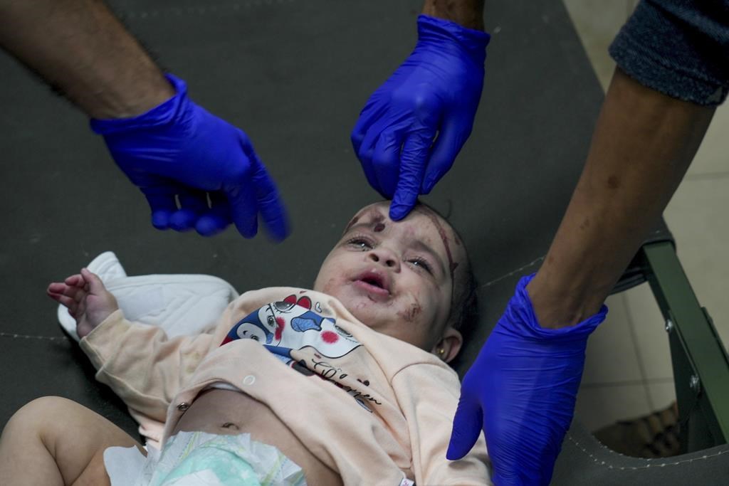 FILE - A Palestinian baby wounded in the Israeli bombardment of the Gaza Strip is treated in a hospital in Deir al-Balah on Tuesday, Nov. 14, 2023