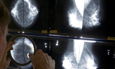 A radiologist checks mammograms for breast cancer